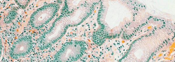 Het microbioom: de rol van je darmflora voor je gezondheid en welzijn - Insentials