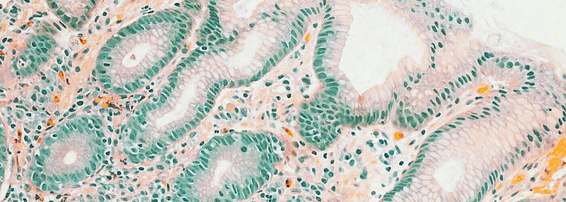 Le microbiome intestinal : la clé de votre santé et bien-être