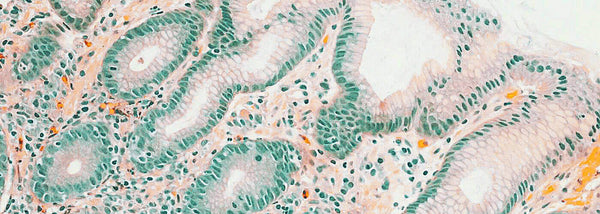 Verbetering darmflora: Hoe een sterk microbioom je gezondheid en welzijn bepaalt - Insentials