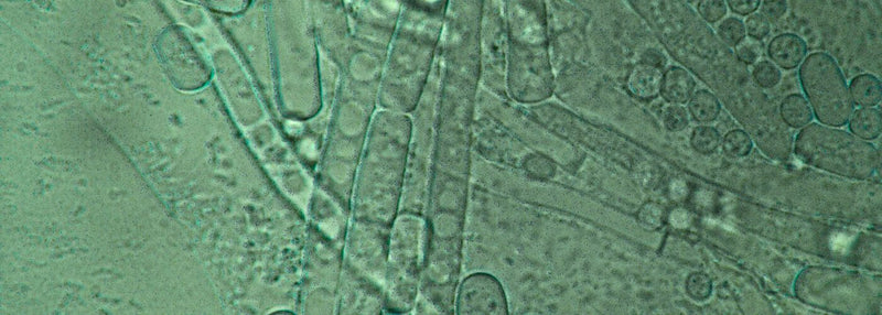 Wat een prebiotica supplement kan betekenen voor je darmen