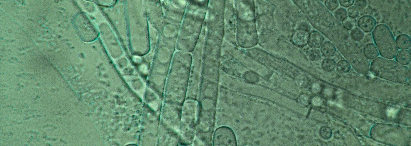 wat prebiotica supplement kan betekenen voor darmen