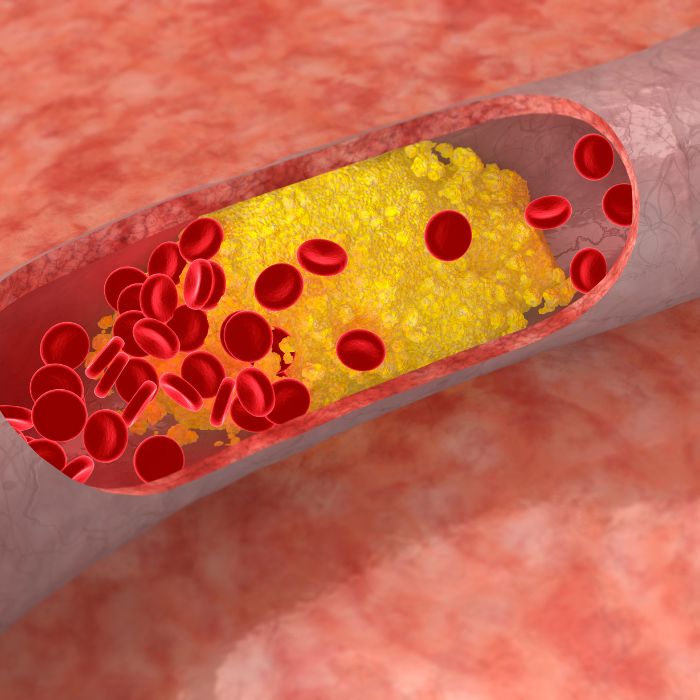Cholesterol