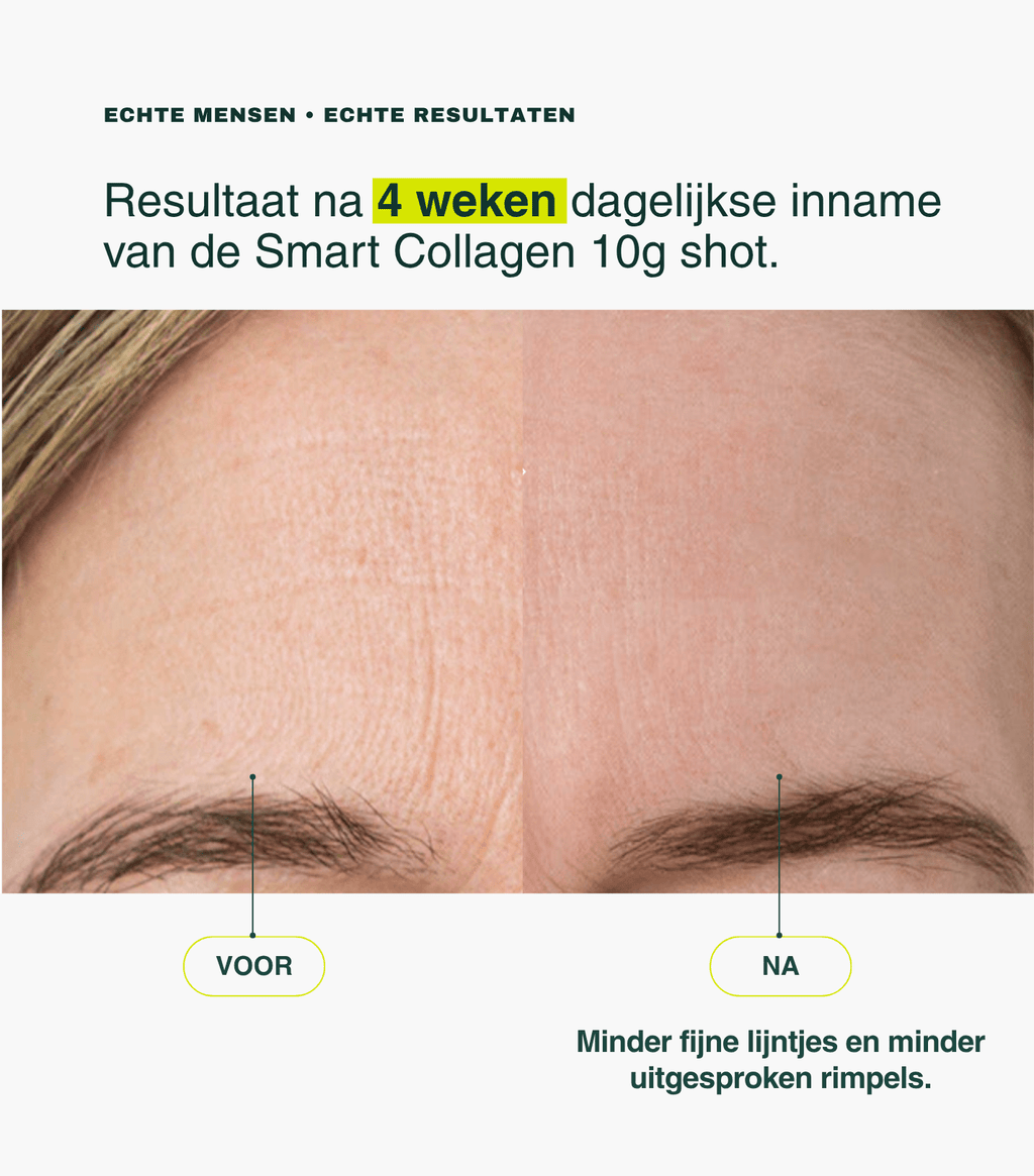 Smart Collagen 10g Shot - Insentials