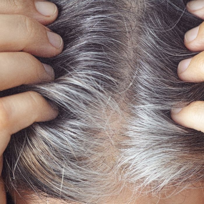 haaruitval menopauze