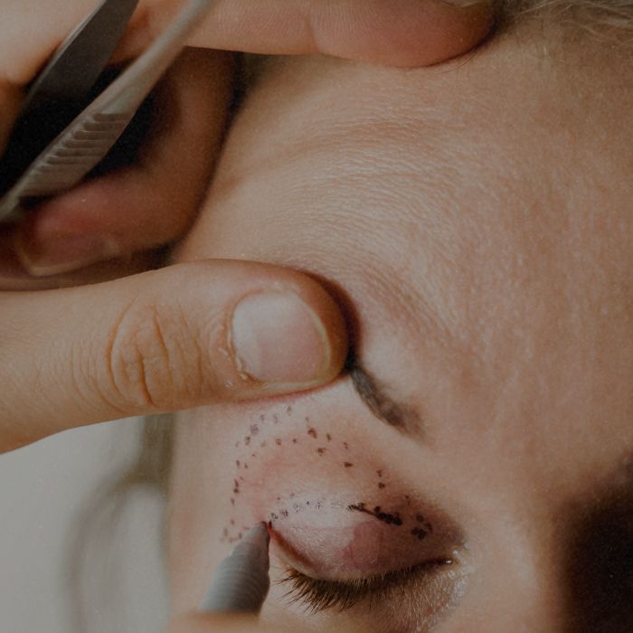 hersteltijd cosmetische ingrepen