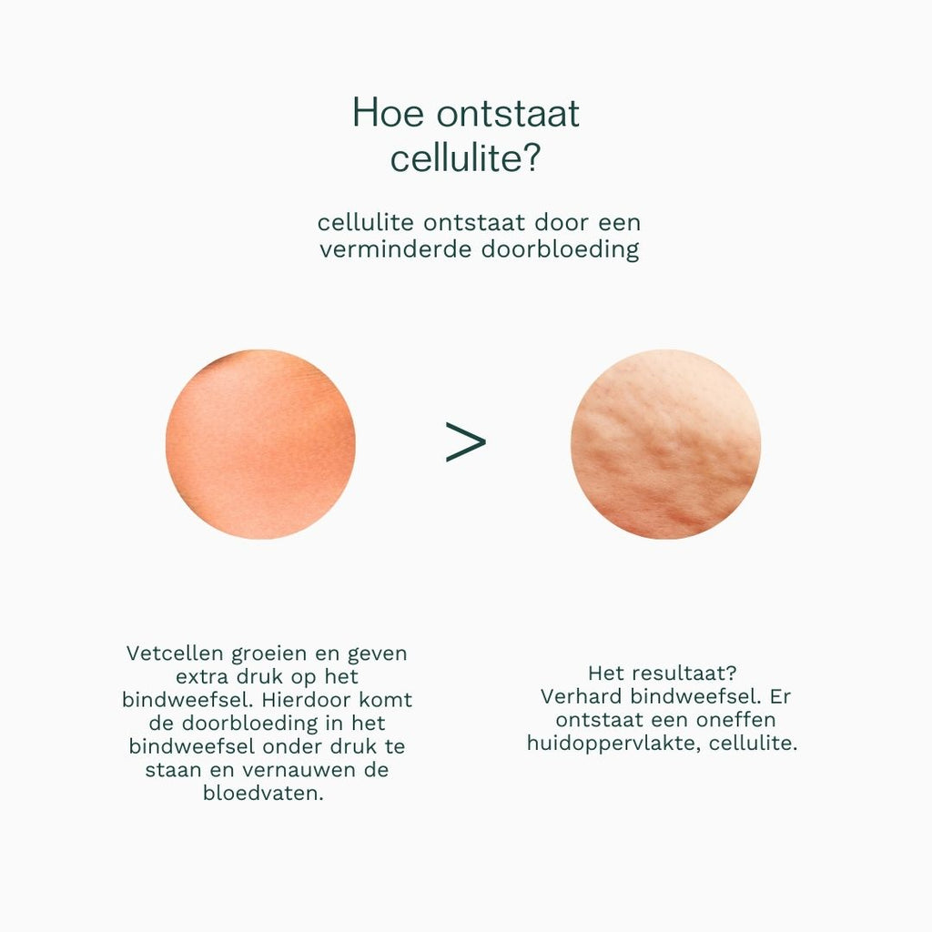 hoe ontstaat cellulite
