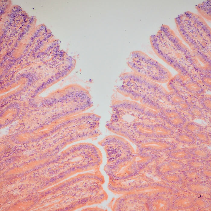 Rol darmflora afweer darmmicrobioom