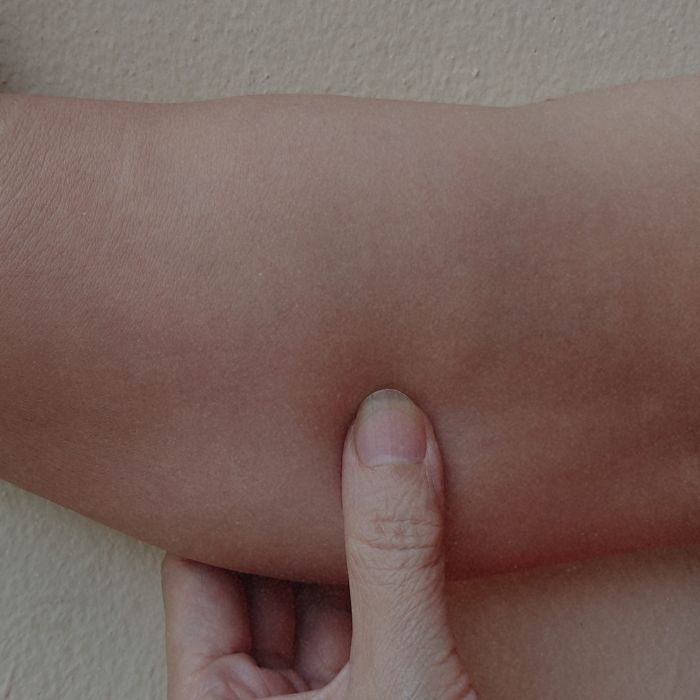 slappere bovenarmen menopauze