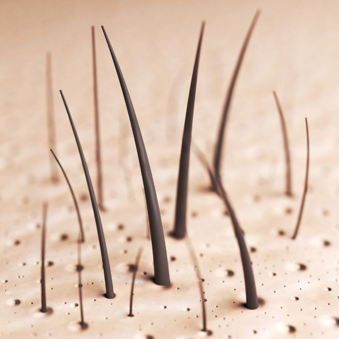 Telogeen effluvium verstoring haargroeicyclus